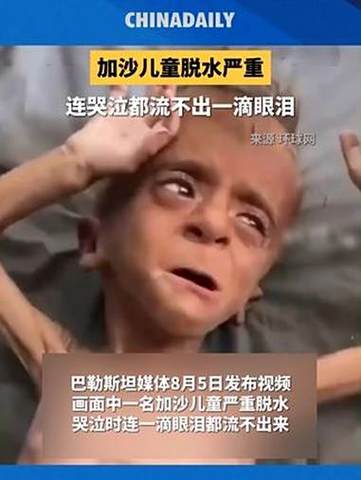 加沙儿童严重脱水危机，无泪的哭声