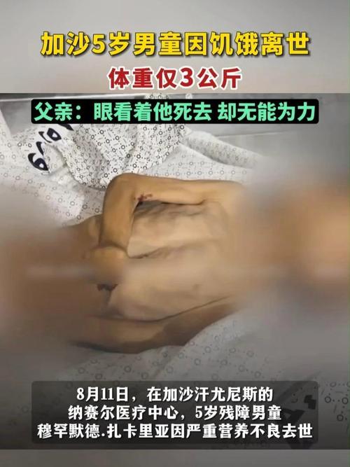 加沙男童因饥饿离世，五岁孩童体重仅三公斤的悲剧引人深思