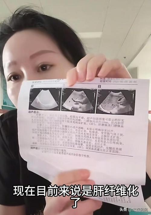 女子历经五次试管成功怀孕却遭遇肝癌挑战