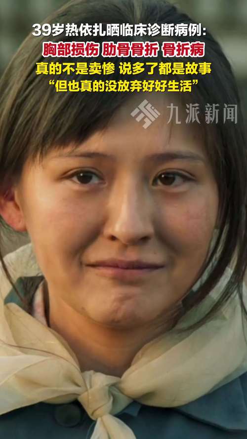 热依扎分享骨折经历，真实感受，并非卖惨