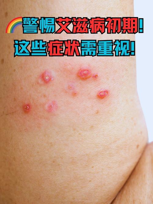韩国将尼帕病毒感染列为一级传染病，疫情严重性与防控措施分析