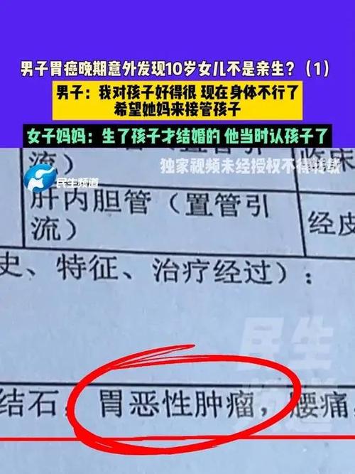 男子胃癌晚期发现女儿身世之谜，十年养育非亲生女儿