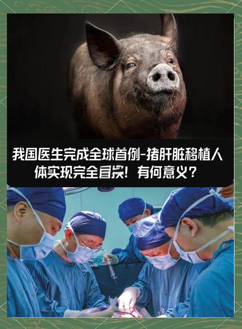 重庆成功完成首例成人亲体辅助肝移植手术，生命重生之旅