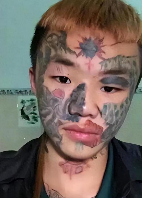 纹面男孩宣称再洗两次纹身即可彻底清除印记，洗纹历程揭秘
