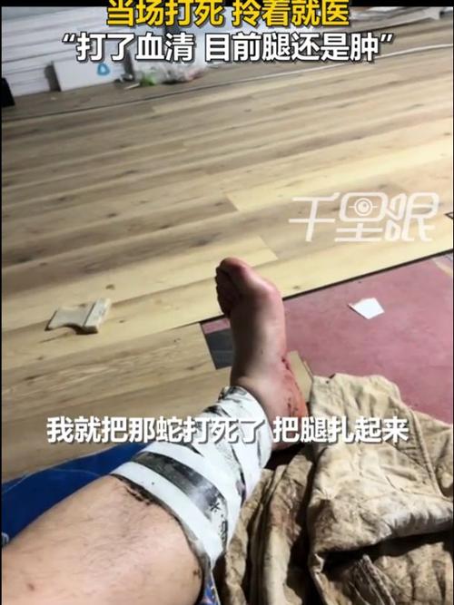 被蛇咬失联男子友人透露,因费用昂贵未打血清,生死未卜