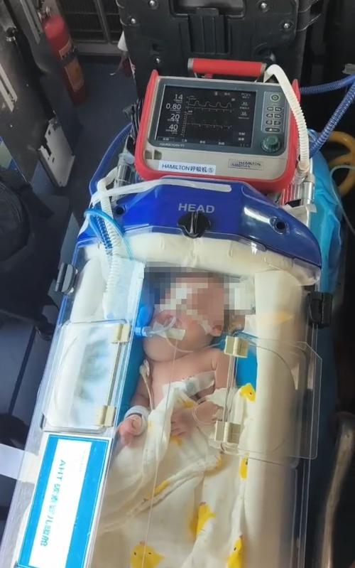 转运坠床新生儿的生命体征观察与评估